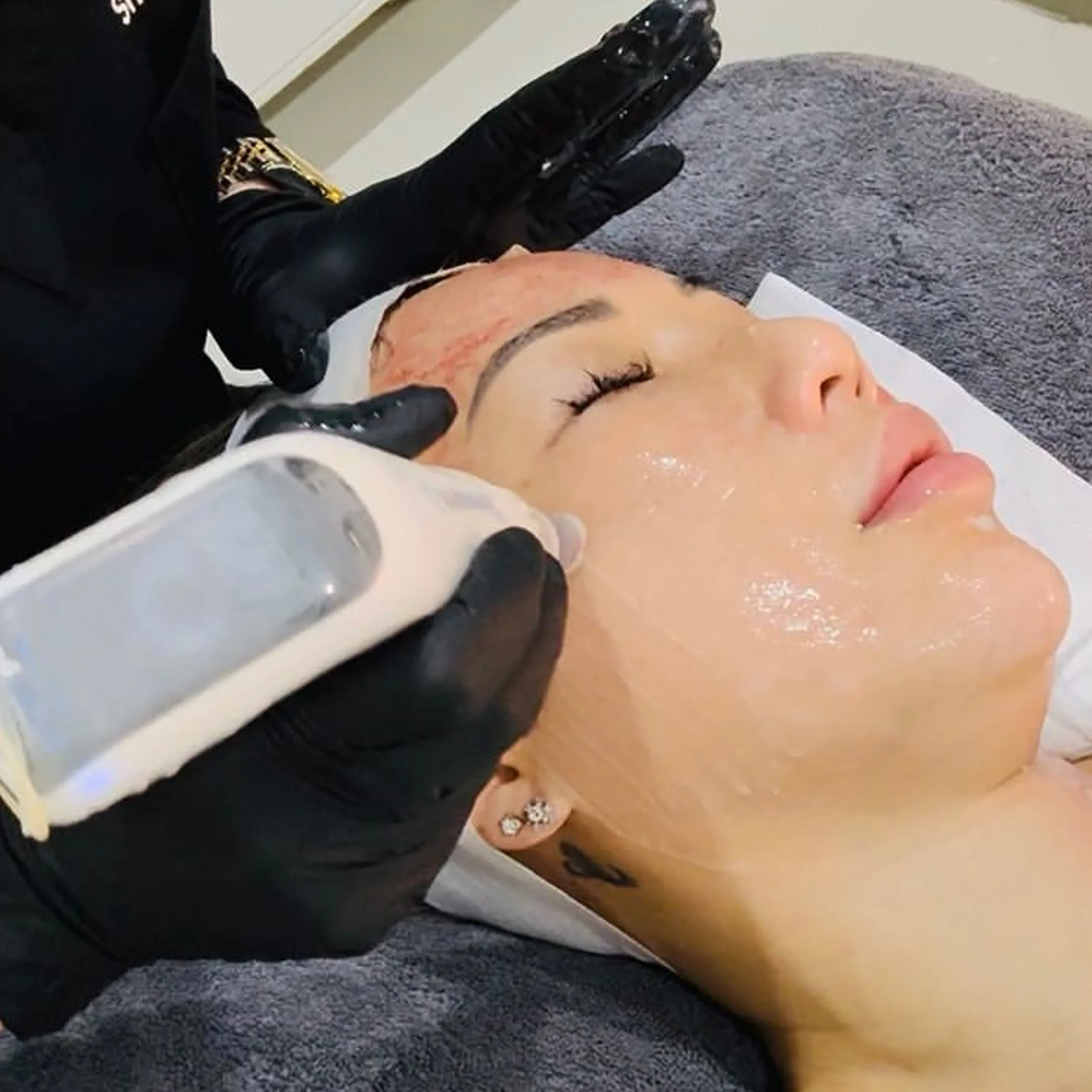 professional dermapen skincare treatment