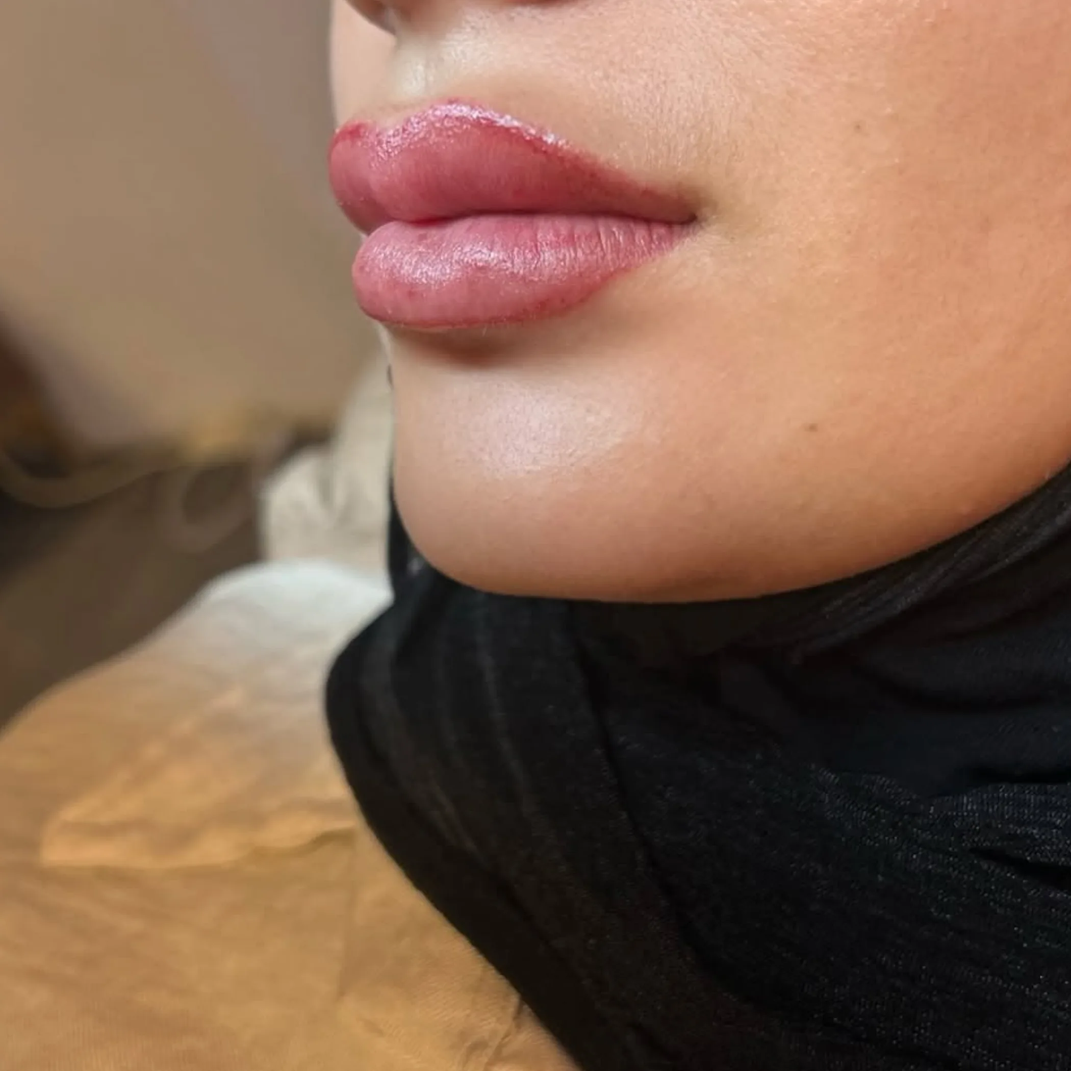 lips showing lip blush treatment
